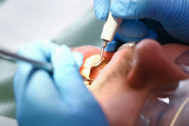 Best Weekend Emergency Dentist in Sachse, TX