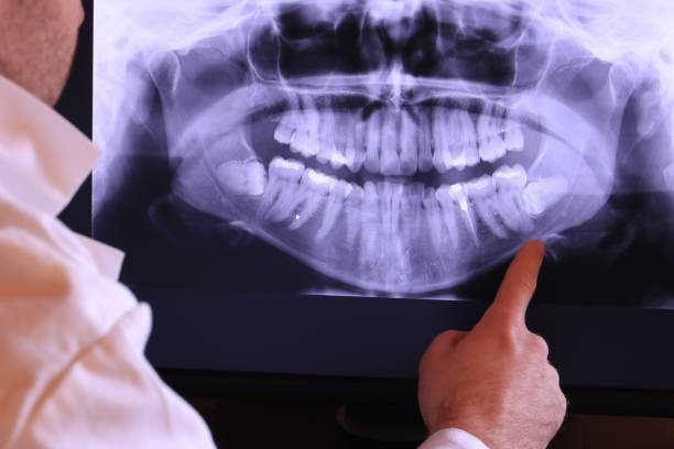 Best Emergency Tooth Extraction in Sachse, TX